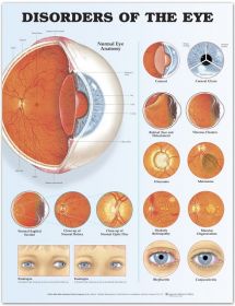 Anatomical Chart - Disorders of the Eye, 2nd Edition