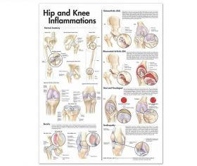 Anatomical Chart - Hip and Knee, 2nd Edition