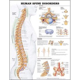 Anatomical Chart - Human Spine Disorders