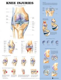 Anatomical Chart - Knee Injuries