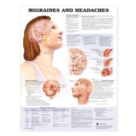 Anatomical Chart - Migraines & Headaches, 2nd Edition
