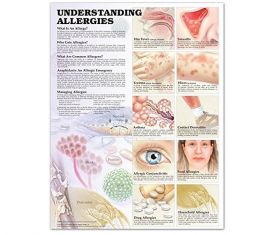 Anatomical Chart - Understanding Allergies, 2nd Edition