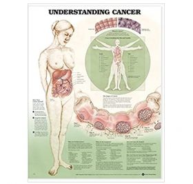 Anatomical Chart - Understanding Cancer