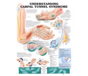 Anatomical Chart - Understanding Carpal Tunnel Syndrome