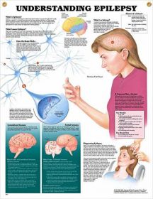 Anatomical Chart - Understanding Epilepsy