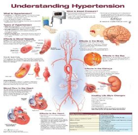 Anatomical Chart - Understanding Hypertension
