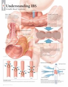 Anatomical Chart - Understanding Irritable Bowel Syndrome