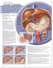 Anatomical Chart - Understanding Liver Cancer