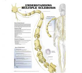 Anatomical Chart - Understanding Multiple Sclerosis