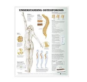 Anatomical Chart - Understanding Osteoporosis, 2nd Edition