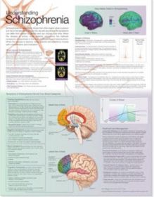 Anatomical Chart - Understanding Schizophrenia
