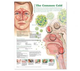 Anatomical Chart - Understanding The Common Cold, 2nd Edition