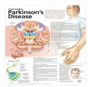 Anatomical Charts - Understanding Parkinson's Disease, 2nd Edition