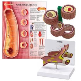 Atherosclerosis Patient Education Collection [Pack of 1]