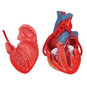 Heart Bypass Model (2 part) [Pack of 1]