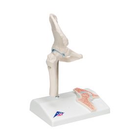 Mini Hip Joint Model with Cross-Section [Pack of 1]