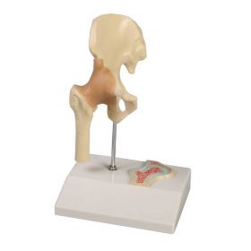 Miniature Hip Joint Model with Cross Section [Pack of 1]