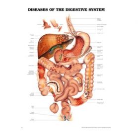 Anatomical Chart - Diseases of the Digestive System