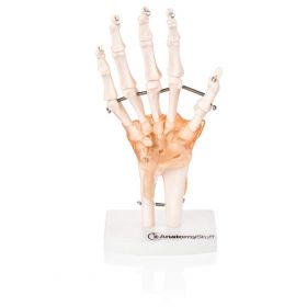 Hand & Wrist Anatomy & Pathology Collection [Pack of 1]