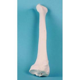 Radius Bone Model [Pack of 1]