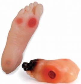 Diabetic Foot Set (2 Models) [Pack of 1]