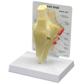 Knee Joint Anatomy Model [Pack of 1]