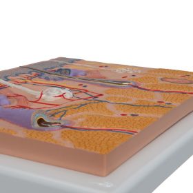 Skin Section Model (X70 enlargement) 1 [Pack of 1]
