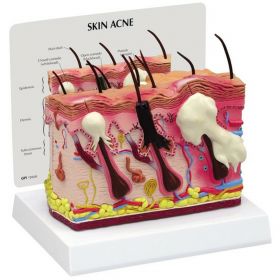 Normal / Acne Skin Model [Pack of 1]