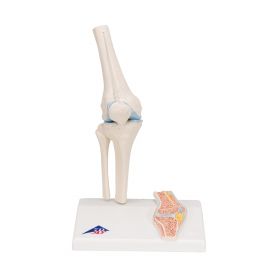 Mini Knee Joint Model with Cross-Section [Pack of 1]