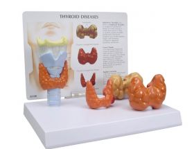 Thyroid Disease Model [Pack of 1]
