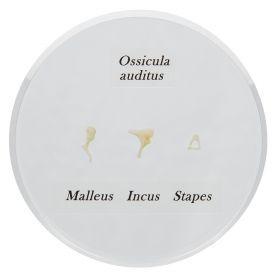 Life-size Auditory Ossicles Model [Pack of 1]