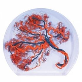 Coloured Model of Placenta [Pack of 1]
