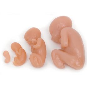 Foetus Model Set (4 part) [Pack of 1]