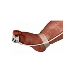 Single Patient Use Adhesive Flexiwrap for Use With Neonate Flex SpO2 Sensor (Pack of 25)