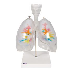 CT Bronchial Tree with Larynx and Transparent Lung Model [Pack of 1]