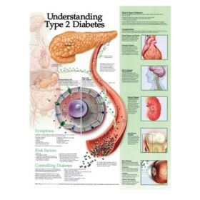 Anatomical Chart - Understanding Type 2 Diabetes [Pack of 1]
